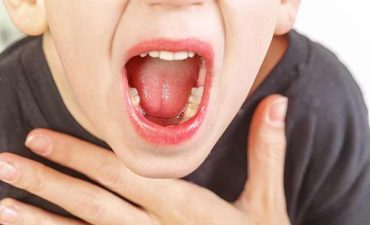 Viêm họng hạt ở trẻ là một trong những bệnh lý hô hấp không hiếm gặp