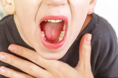 Viêm họng hạt ở trẻ là một trong những bệnh lý hô hấp không hiếm gặp