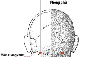Huyệt Phong trì nằm ở phía hõm sau gáy tại cả hai bên
