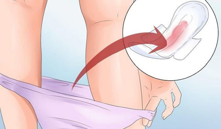 Cách giải quyết nếu bị chảy máu khi đặt thuốc viêm cổ tử cung
