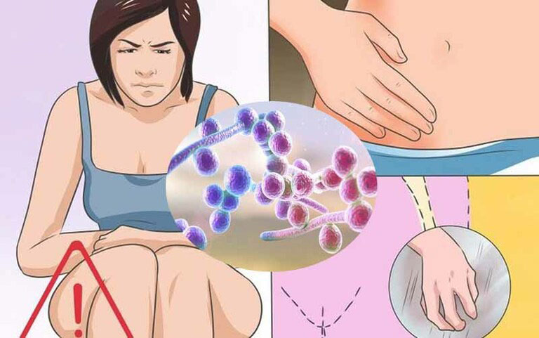 Nấm Candida thường gây bệnh ở vùng sinh dục