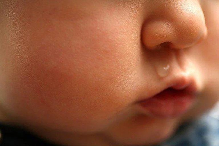 Trẻ có dấu hiệu sổ mũi, chảy nước mũi