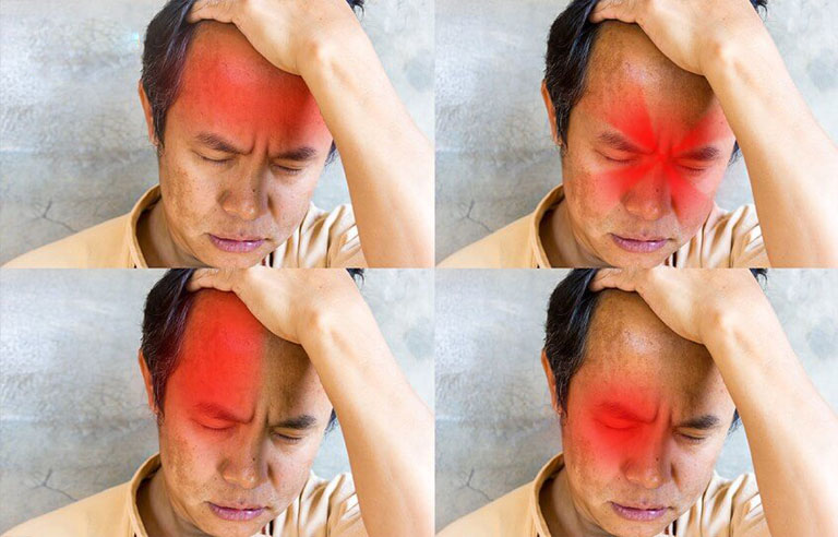 Bị nhức đầu thường xuyên cùng nhiều triệu chứng đi kèm