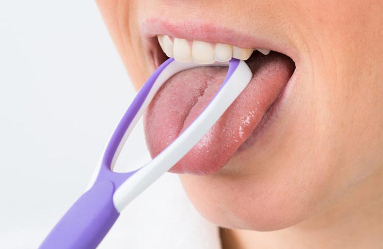 Cuống lưỡi nổi mụn trắng và vi khuẩn tích tụ trên bề mặt lưỡi