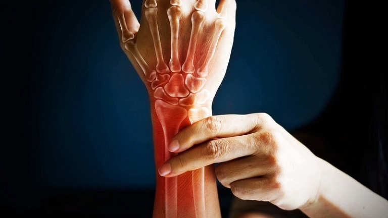 Có rất nhiều nguyên nhân dẫn đến tình trạng cánh tay bị đau nhức trong xương 