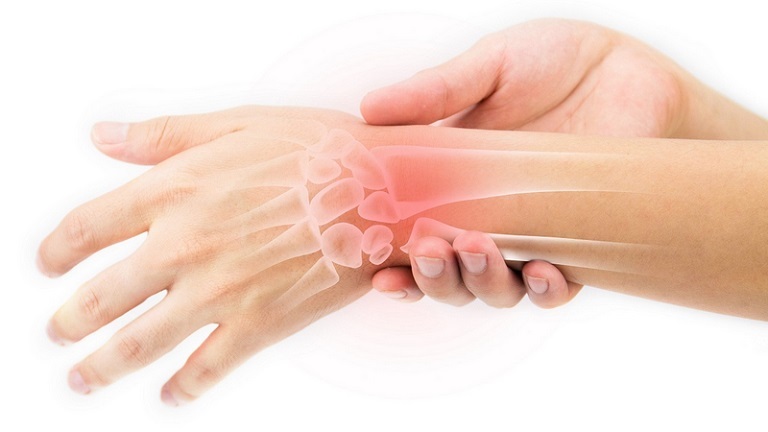 Tay bị đau nhức trong xương thường xảy ra ở vùng cổ tay 