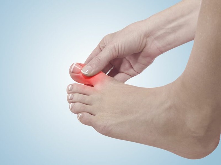Tê đầu ngón chân cái là hiện tượng đầu ngón chân cái bị tê rần hoặc ngứa ran